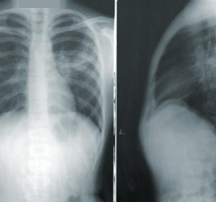 Teleradiologia