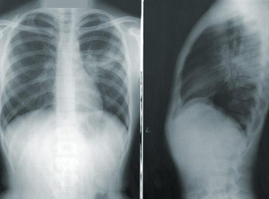 Teleradiologia