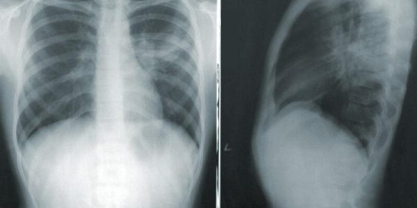 Teleradiologia